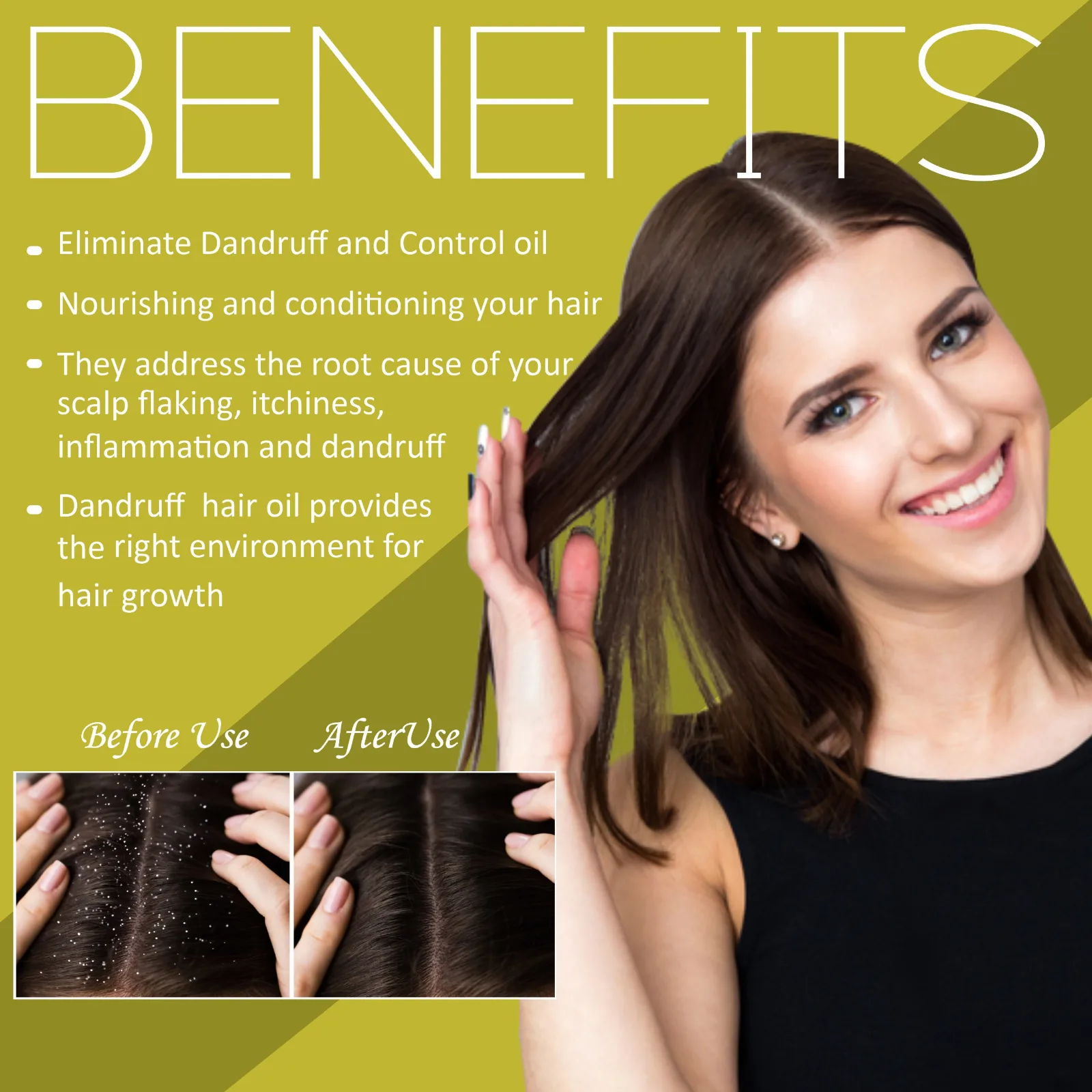 Pink Root Dandruff Control Oil |Dandruff Reduction, Prevents Itching, Scalp Nourishment |Hair Oil 100ml view 2